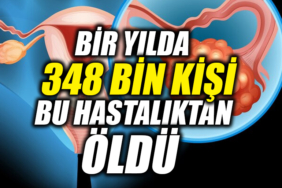 34T34T34T