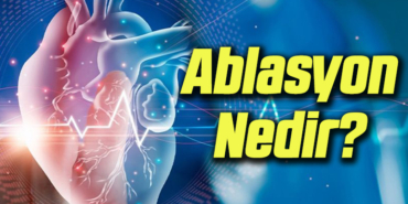 ablasyon