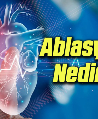 ablasyon